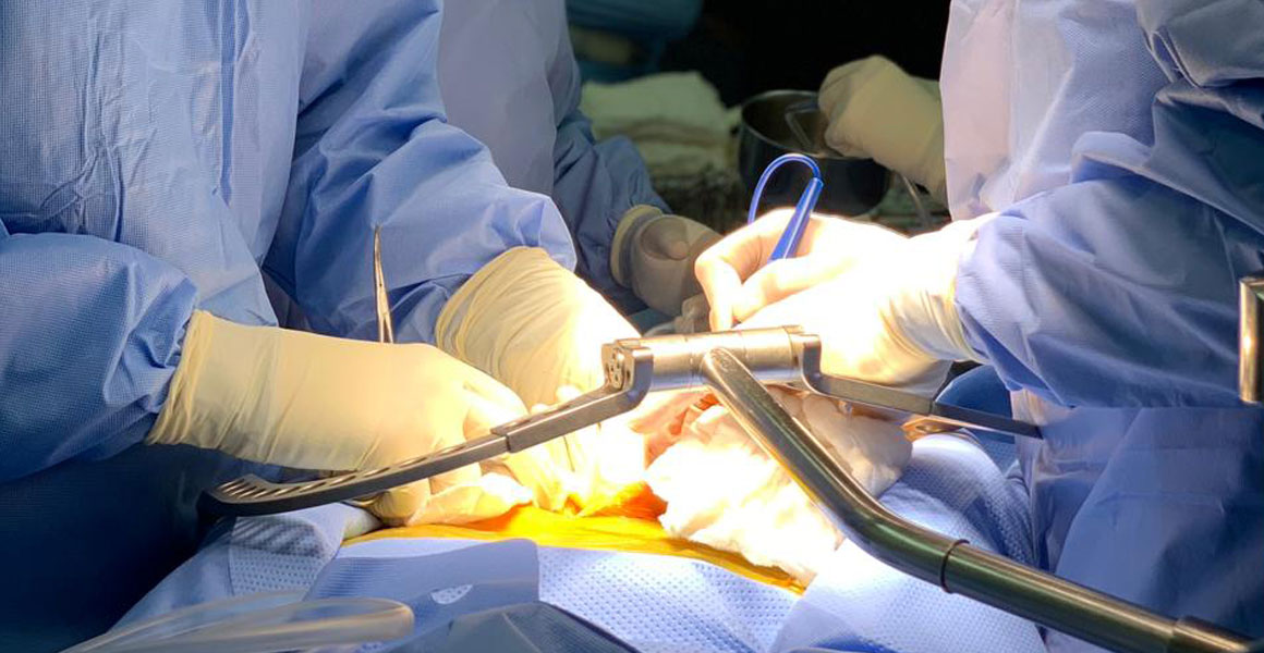 Trasplante Hepático