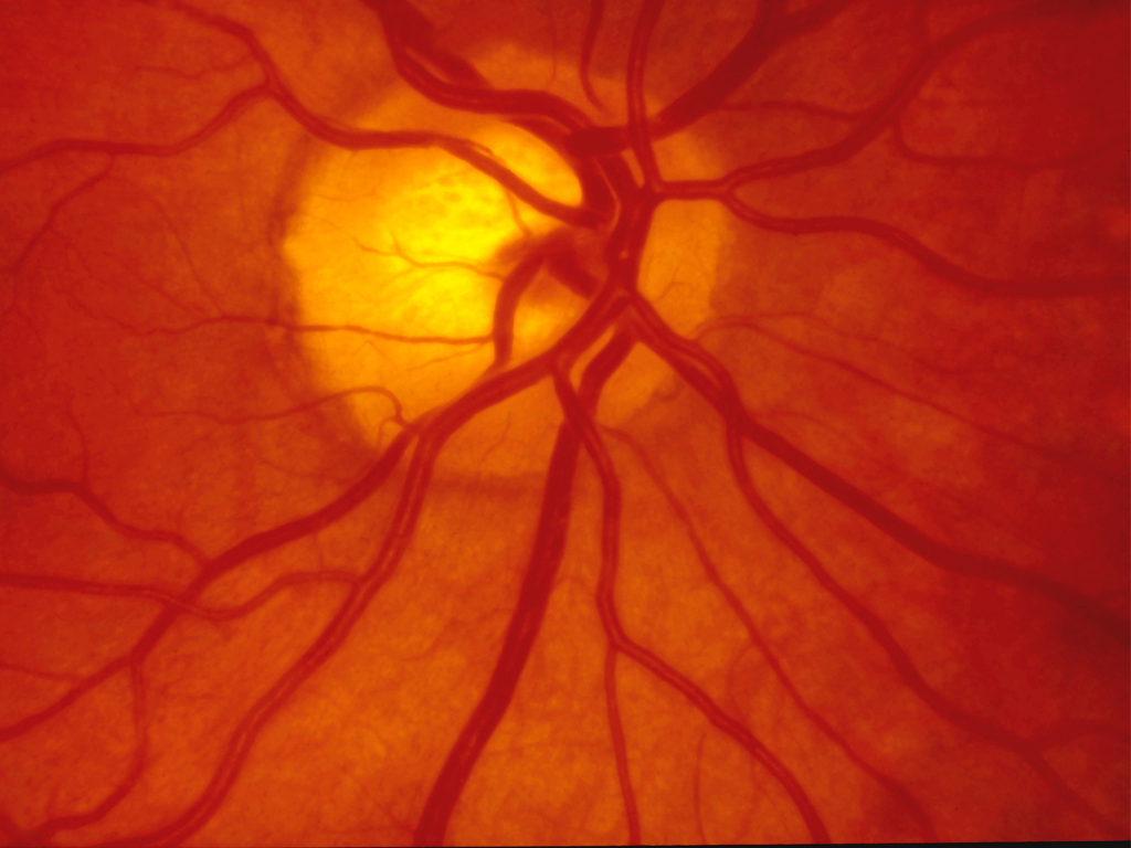 Retina: donde la visión se juega en detalle