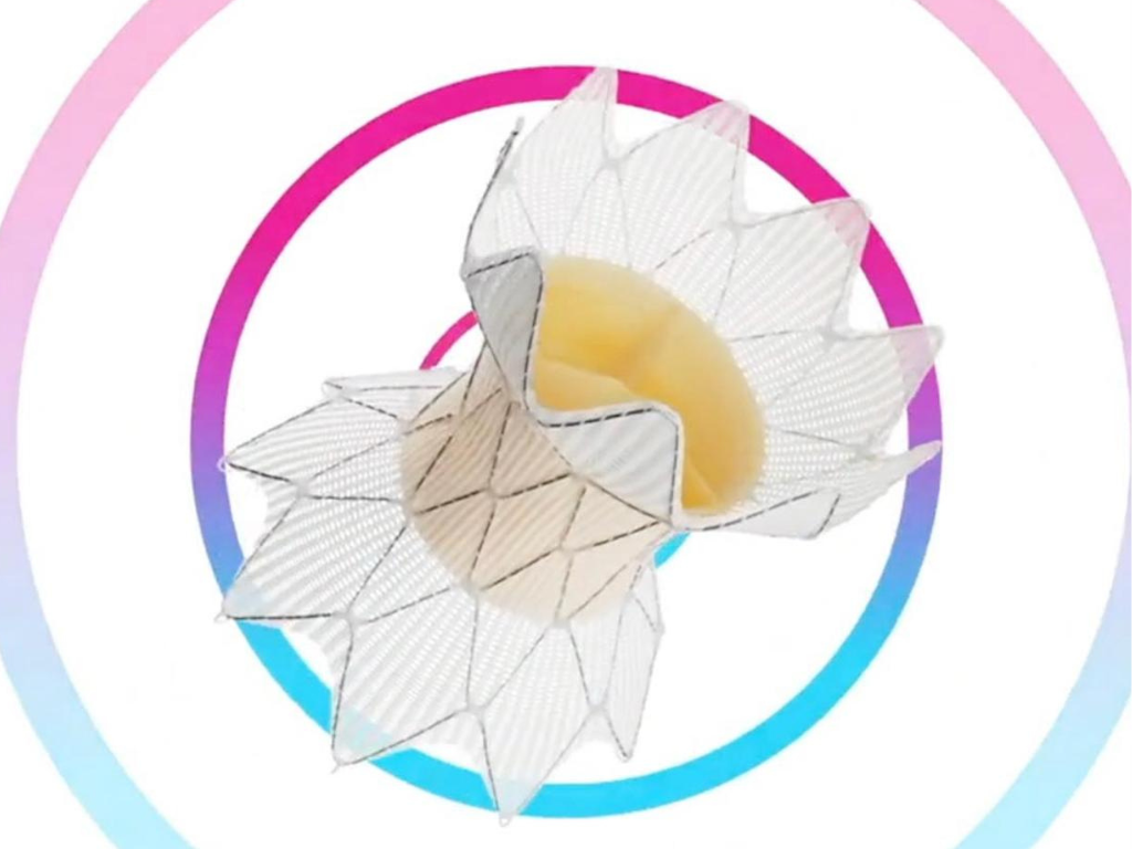 Innovación en Cardiología: el Hospital Universitario Austral realiza el primer implante en Buenos Aires de la válvula Harmony