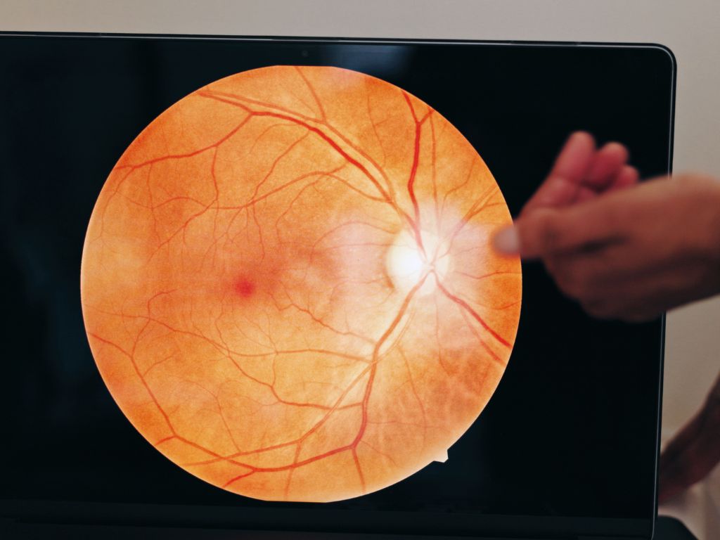 Mucho más que visión borrosa: para qué sirve realmente un fondo de ojos