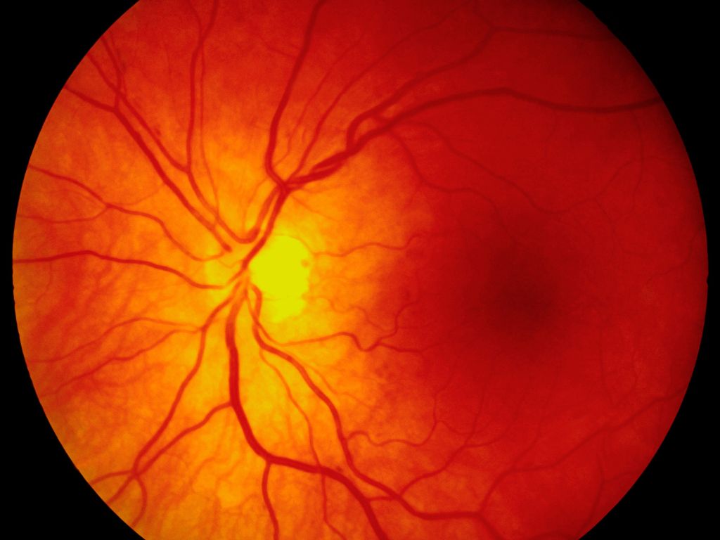 Mucho más que visión borrosa: para qué sirve realmente un fondo de ojos