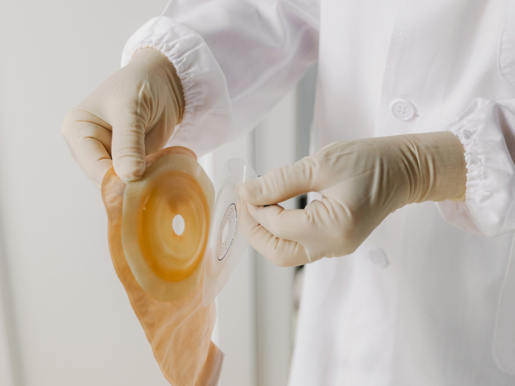 Con una ostomía: una vida plena es posible